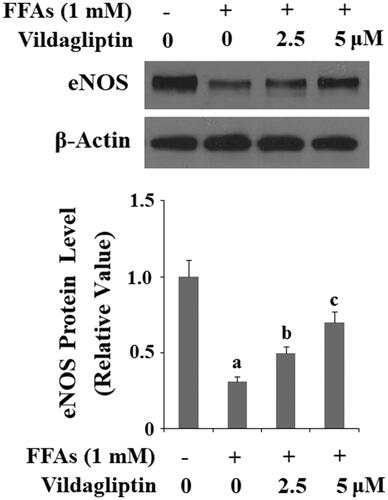 Figure 9. Vildagliptin suppresses FFA-induced reduction of eNOS. Human umbilical vein endothelial cells (HUVECs) were treated with high FFAs (1 mM) in the presence or absence of vildagliptin (2.5 μM, 5 μM) for 24 h. eNOS was determined by Western blot analysis (a, b, c, p < .01 vs. previous column group).