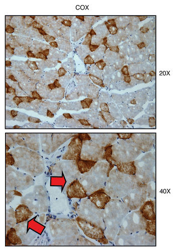 Figure 5 Visualizing mitochondrial complex IV (COX) activity in murine skeletal muscle tissue. Frozen sections of murine skeletal muscle (hind-limb/gastronemius) were subjected to COX activity staining (brown color). Slides were then counter-stained with hematoxylin (blue color). Note that slow-twitch fibers (type I) are oxidative, are mitochondria-rich, and are COX-positive (see red arrows). In contrast, fast-twitch fibers (type II) are glycolytic, are mitochondria-poor, and are COX-negative. Two representative images are shown. Original magnification, 20x and 40x, as indicated.