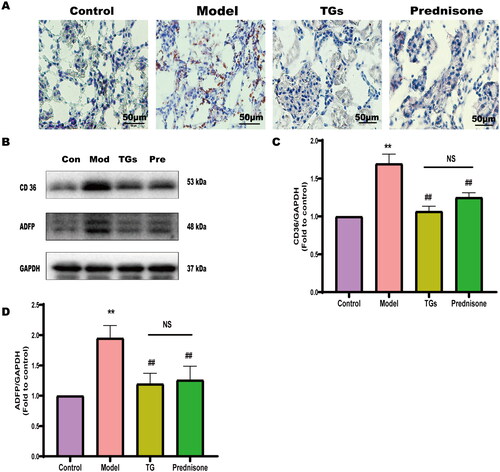 Figure 3. TGs alleviate abnormal lipids in NS. (A) Oil Red O and hematoxylin staining of kidney sections (n = 3; scale bar: 50 µm). (B–D) Expression of CD36 and ADFP in renal tissues (n = 3). Significance between groups was determined by ANOVA followed by Tukey. Model group vs. Control group (**p ≤ 0.01); TGs group or Prednisone group vs. Model group (#p ≤ 0.05 and ##p ≤ 0.01); TGs group vs. Prednisone group (NS p > 0.05).