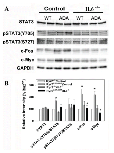 FIGURE 4. Expression of IL-6 downstream signaling molecules in mice targeted for Ryr2ADA and IL-6−/−. (A) Immunoblots of heart homogenates from 10-day old Ryr2+/+ (WT) and Ryr2ADA/ADA (ADA) mice with and without IL-6. GAPDH was the loading control. (B) Protein levels and phosphorylation ratios of Ryr2ADA/ADA mice were normalized to Ryr2+/+. Data are the mean ± SEM of 6–14 determinations. Footnotep < 0.05 compared with Ryr2+/+, #p < 0.05 compared with Ryr2ADA/ADA, using one way ANOVA.