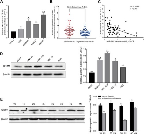 Figure 5 CRIM1 is upregulated in GC cell lines and tissues. (A) qRT-PCR results of CRIM1 expression level in GC cells and GES-1 cells. (B) qRT-PCR results of CRIM1 expression level in 63 pairs of GC and adjacent normal tissues. Data are shown as –ΔΔCT values. (C) Association between CRIM1 and miR-665 expression levels was analyzed in 63 GC patients by Spearman correlation analysis. (D) Western blot results of CRIM1 protein levels in GC and GES-1 cells. (E) CRIM1 protein level was measured using Western blotting in four GC patients. Data are presented as mean ± SD. *P < 0.05, **P < 0.01.