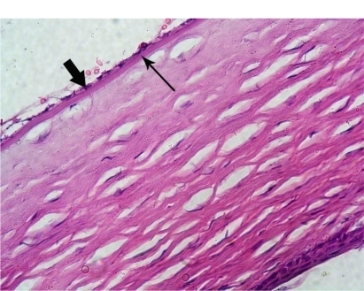 Figure 3 Photomicrograph of a control rabbit cornea showing flat endothelial cells with flat nuclei (thick arrow) resting on Descemet’s membrane (thin arrow). Hematoxylin and eosin staining, 400×.