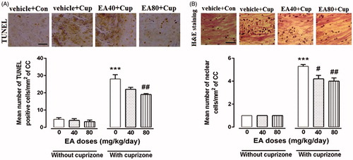 Figure 3. Evaluation of gliosis and apoptosis during EA treatment. Haematoxylin and eosin (H&E) staining was performed to study effect of different doses of EA treatments on cup-induced reactive gliosis and trans-endothelial migration of immune cells in the CC region. TUNEL assay confirmed that high dose of EA significantly reduced population of apoptotic cells in CC (A). Moreover, quantification of H&E indicate significantly lower amount of cell infiltration after EA treatments (B). Vehicle + con: mice on a regular diet and injected with vehicle for 4 weeks (n = 3), vehicle + cup: cuprizone plus vehicle injection for 4 weeks (n = 3), EA-40 + cup: cuprizone mice were injected with 40 mg/kg of EA for 4 weeks (n = 3), EA80 + cup: cuprizone mice were injected with 80 mg/kg of EA for 4 weeks (n = 3). Scale bar =75 μm, original magnification ×40. Data are expressed as means ± SEM. *Compared with control mice, #compared with cuprizone (#p < 0.05, ##p < 0.01 and ***p < 0.001).