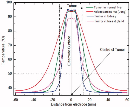 Figure 6. Temperature profile obtained after 10 min of ablation procedure for different tissues as a function of distance from the electrode (measured perpendicular to electrode surface).