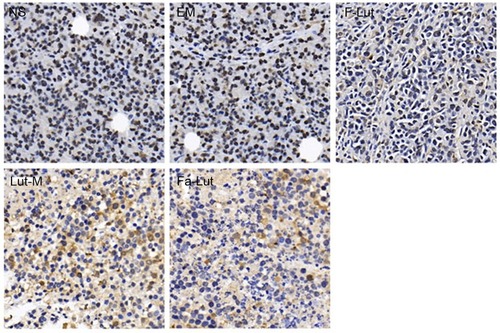 Figure 11 Immunohistochemical analysis of PCNA. Mechanism of antitumor effect of Fa-lut micelles on GL261 subcutaneous mouse model. PCNA antibody was used to stain tumor sections of five groups, in order to evaluate the proliferation of tumor cell.