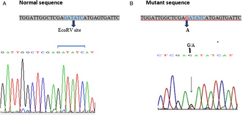 Figure 4. Chromatogram pictures of FLT3-D835 mutation.