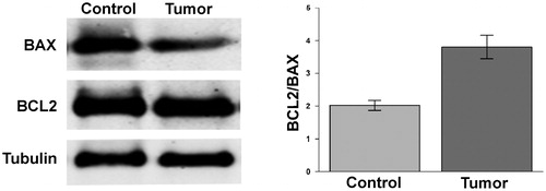 Figure 4. Ratio BAX/BCL2 in ccRCC samples. Protein levels of BCL2 and BAX evaluated by WB in normal tissue (Control) and tumour sample (tumour) of a representative patient. Tubulin was used to normalise values in WB. In left panel are reported the ratio between the values of BCL2 versus BAX. Differences were significant for p ≤ .005.