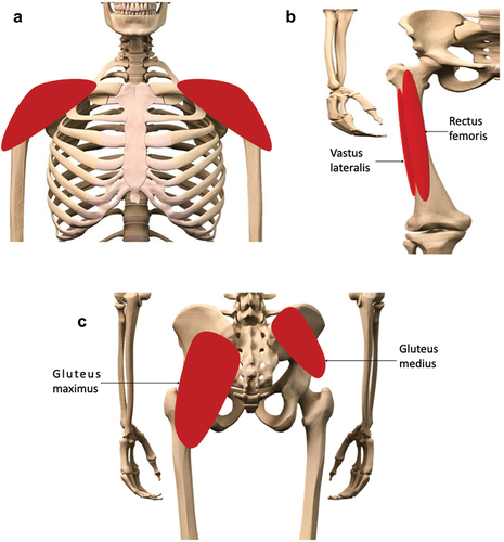 Figure 1. Preferred sites for intramuscular (IM) injections in the human body. Depending on volume of injectate to be administered, IM injections are performed into the mass of the A) deltoid muscle, B) rectus femoris, vastus lateralis, or C) the dorsogluteal plane of the gluteus medius muscle. The gluteus maximus muscle, though no longer recommended for IM injections, due to risk of sciatic nerve damage, is shown here for context.