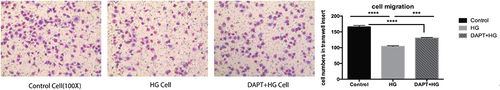 Figure 3 Representative images taken from transwell chambers displayed the cell migration in control group, HG group and DAPT+HG group, from left to right, respectively. Compared with control group, fewer cells were observed in both HG group and DAPT+HG group, which indicated that cell migration was significantly induced by HG stimulation. Compared with HG group, more cells remained in transwell chamber in DAPT+HG group. *** P < 0.001, **** P < 0.0001.