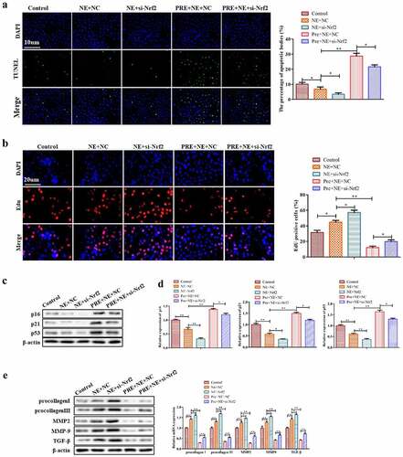 Figure 6. The effect of Nrf2 knockdown on the myocardial fibrosis. (a) Representative pictures of TUNEL assay of cardiac fibroblasts. TUNEL-positive cells were stained green. (b) Representative images of EdU-positive cardiac fibroblasts. (c) Western blots of p16, p21 and p53 proteins in cardiac fibroblasts. (d) Qrt-PCR analysis was conducted to detect procollagen I, procollagen III, MMP2, MMP9, and TGF-β mRNA levels in cardiac fibroblasts using GAPDH as the housekeeping gene. (e) Western blotting of procollagen I, procollagen III, MMP2, MMP9 and TGF-β proteins in cardiac fibroblasts. **P < 0.01, *P < 0.05 vs. control, ##P <0.01, #P <0.05 vs. NE. Data were presented as mean±SD from three independent experiments.