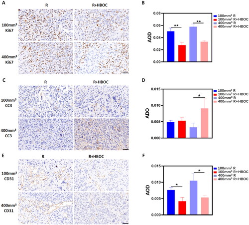 Figure 5. Tumour metastasis and invasion in vivo. (A) IHC staining of Ki67 and (B) AOD analysis in Hela tumour model. (C) IHC staining of CC3 and (D) AOD analysis in Hela tumour model. (E) IHC staining of CD31 and (F) AOD in analysis in Hela tumour model. Representative images of each group were shown. Scale bar = 50 μm. Data between two groups was compared by student’s t-test (n = 3). *p < 0.05. **p < 0.01.