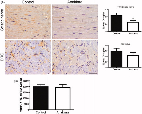 Figure 1. Anakinra prevents TTR deposition in the sciatic nerve and does not alter TTR expression by the liver. (A) Representative pictures of TTR load in sciatic nerve and DRG of Hsf/V30M mice treated with Anakinra (right panels, n = 10) and age-matched controls (left panels, n = 10). Scale bar 50 µm. Charts represent the quantification of immunohistochemical images, and data represent mean ± SEM (*p < 0.05). (B). Histogram represents TTR mRNA levels in the liver of Anakinra-treated mice (n = 10), as compared with controls (n = 10). Gapdh was the housekeeping gene for normalization. Data represent mean ± SEM.