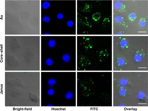 Figure 2 Endocytosis of three rod-like gold-mesoporous silica nanoparticles.Notes: Confocal microscopy of the cellular uptake behavior of FITC-labeled AuNPs, core–shell Au@mSiO2NPs, and Janus Au@mSiO2NPs in MCF-7 cells. Green florescence, FITC; blue florescence, nuclei stained with Hoechst 33258. Scale bars represent 10 µm.Abbreviations: AuNPs, gold nanoparticles; FITC, fluorescein isothiocyanate.