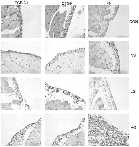 Figure 4. The expression of CTGF, TGF-β1, and FN proteins of peritoneal tissue by Immunohistochemical methods (×400).