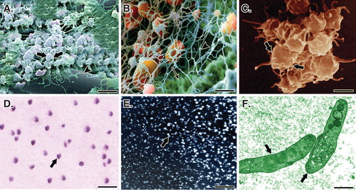 Figure 2. A. A SEM of the PG embedded within the CI. Note that the platelets (arrows) are well attached to the collagen fibers (arrow head) of the bioimplant. B. In a larger magnification, the activated platelets (thick arrow) are attached to the fibrin matrix (arrow head) and the collagen fibers of the implant (thin arrow). C. A SEM of the activated and accumulated platelets. D. Cytological figure of the bovine platelets after the second step centrifugation. Note that the cytological section is filled with only the platelets. E. The cytologic section of the bovine PRP under polarized microscope. F. The TEM of the bovine platelets after the second centrifugation. Scale bar: A, 1 µm; B, 750 nm; C, 500 nm; D, 3 µm; E, 12 µm; F, 630 nm.