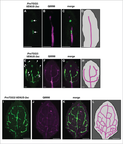 Figure 1. Spatiotemporal patterns during leaf development differ between the myrosin cell reporter and the vascular precursor cell reporter Q0990. The abaxial side of a juvenile leaf in a transgenic plant that expresses both the myrosin cell reporter ProTGG2:VENUS-2sc and the vascular precursor cell reporter Q0990. Fluorescent images of myrosin cells (green; [A], [E], and [I]) and vascular precursor cells (magenta; [B], [F], and [J]) at DAG3 (upper panels), DAG4.5 (middle panels), and DAG7 (lower panels). Merged images of the leaves are shown ([C], [G], and [K]). Schematic representations show vascular precursor development (magenta) in the juvenile leaf at DAG3 (D), DAG4.5 (H), and DAG7 (L). Myrosin cells are indicated by arrows in (A). The green fluorescent punctate structures are guard cells (indicated by arrowheads in [E]). Bars = 50 μm in (A) to (H), and 200 μm in (I) to (L).