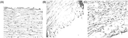 Figure 2. Microscographs of HE staining on rabbit thoracic aorta (200 ×): (A) normal group, (B) 240 mg/kg geniposidic acid group, and (C) model control group.