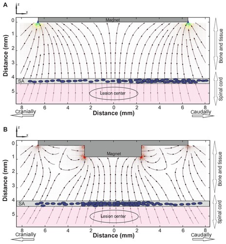 Figure 5 Magnetic force lines near the surfaces of flat (A) and stepped (B) magnets.Notes: The arrow lines show the directions of forces acting on a magnetically labeled cell. The corresponding distribution of transplanted cells in the subarachnoid space of the spinal cord under both types of magnet is schematically shown by the blue dots. The areas with the highest values of the magnetic force are progressively marked in green, orange, and red.