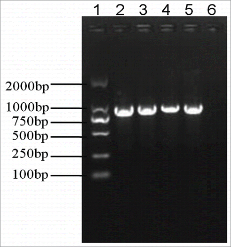 Figure 2. Detection of the pagA gene on the plasmid pXO1 in vaccine strains by PCR amplification. The pagA gene was amplified in all 3 vaccine strains: Pasteur II (Lane 2), Qiankefusiji II (Lane 3), and Rentian II (Lane 4). Lane 1 is a standard DNA marker, Lane 5 is A16R positive control, and Lane 6 is negative control.