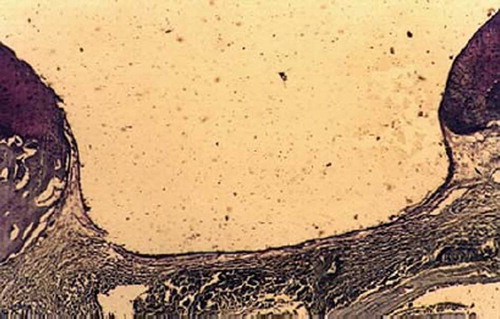 Figures 7. Sagittal sections of cartilage defects transplanted with MSCs derived from control group (6) at 12 weeks (toluidine blue staining × 400).