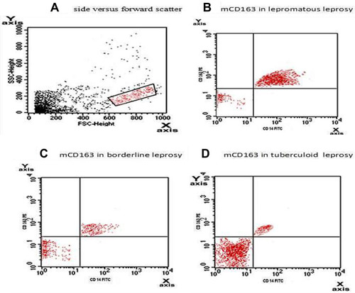 Figure 1 (A) Forward scatter versus side scatter with primary gate on the monocyte region depending on cell size and granularity. (B-D) The monocyte area was selected where double positive for both CD163 PE and CD 14 FITC. The single CD14 FITC positive are in the lower right quadrant, single CD163 PE positive are in the upper left quadrant, double positive are in the upper right quadrant. LL had significantly higher mCD163 (46.68±22.17) than BL (16.80±8.71) and TL (14.72±3.41) (p<0.001), but insignificant difference between BL and TL (p=0.1).