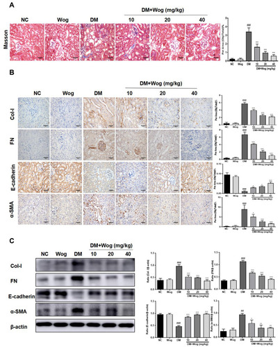 Figure 3 Wogonin attenuates renal fibrosis in diabetic mice. (A) Masson staining and score of severity. (B) Immunohistochemistry of Col-I, FN, E-cadherin and α-SMA in mice kidney. (C) Western blot analysis of Col-I, FN, E-cadherin and α-SMA in mice kidney. Results represent means ± SEM for 6–8 mice. ##p < 0.01, ###p < 0.001 VS NC. *p < 0.05, **p < 0.01, ***p < 0.001 VS DM. Scale bar = 50μm.