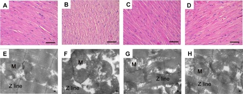 Figure 6 Actions of MAG on histopathological changes of animals’ cardiac tissue colored with H&E and ultrastructural changes. Representative sections (magnification: 400×) were from the heart of the Con (A), ISO (B), MAG (C), and Ver (D) groups. Scale bar: 50 μm. The ultrastructure of heart tissues was detected by Transmission Electron Microscope (magnification: 15,000×) from the left ventricle of the Con (E), ISO (F), MAG (G), and Ver (H) groups. Scale bar: 1.0 μm.