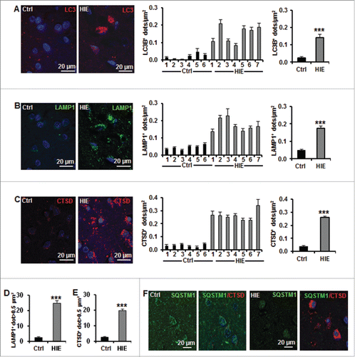 Figure 9. Neuronal autophagy is enhanced in the lentiform nucleus of asphyxiated human term newborns. (A) Representative confocal images of LC3B staining (red) in neurons in the lentiform nuclei of human newborns, and quantifications of the numbers of LC3B-positive dots per neuron per μm2 (left histogram) in 6 controls (Ctrl) and 7 hypoxic-ischemic encephalopathy (HIE) cases, showing an increase in autophagosome in all HIE cases. Right histogram showed the average numbers of LC3B-positive dots of control (0.021 ± 0.007) and HIE (0.149 ± 0.018) cases. Representative confocal images of (B) LAMP1 staining (green) and (C) CTSD staining (red) in lentiform nuclei of human newborns and the quantifications of the numbers of positive dots per neuron per μm2 (left histograms) in the different cases individually demonstrated an increase in lysosomes in all HIE cases. Right histograms showed the average numbers of positive dots of control (LAMP1: 0.046 ± 0.005; CTSD: 0.035 ± 0.004) and HIE (LAMP1: 0.172 ± 0.013; CTSD: 0.260 ± 0.014). Quantifications showing the average percentages of (D) LAMP1- and (E) CTSD-positive dots larger than 0.5 μm2 per neuron in control (LAMP1: 2.5 ± 1.9%; CTSD: 2.6 ± 1.8%) and HIE cases (LAMP1: 24.8 ± 6.2%; CTSD: 19.8 ± 3.6%). (F) Representative confocal images of SQSTM1 staining (green) and CTSD (red) in neurons in human newborn lentiform nuclei showed that SQSTM1 expression was not increased (or accumulated) in neurons of HIE cases (right panels) (***, P<0.001).