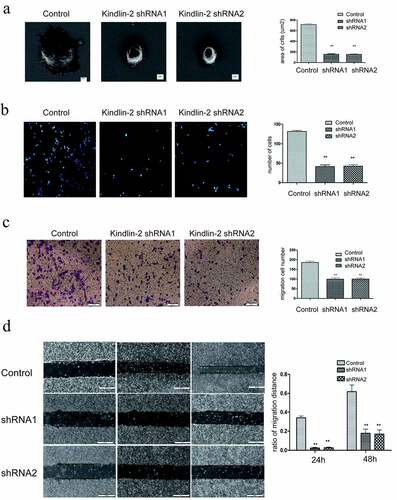 Figure 3. Down-regulation of Kindlin-2 expression inhibits cell migration, cell adhesion and spreading. a: Morphological changes in vascular endothelial cells after 4 hours of adherence were observed by field emission electron microscopy. Bar = 2 μm. The spreading area of cells in each group was calculated by ImageJ. b: The adhesion of cells in each group for 4 hours was observed by immunofluorescence. Bar = 50 microns. The adhesion ability of each group was compared by calculating the number of adherent cells. c: Transwell chamber experiments were conducted to observe the migration changes of the control group, Kindlin-2 shRNA1 group and Kindlin-2 shRNA2 group after 12 hours, bar = 200 μm. d: The migration of the control group, Kindlin-2 shRNA1 group and Kindlin-2 shRNA2 group was observed to be 500 μm by the scratch test. The migration ability of each group was compared by calculating the relative migration distance