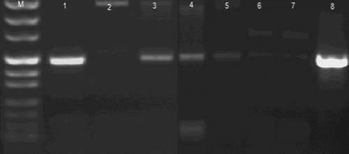 Figure 2. Detection of BHV-1 in the nasal swabs by the PCR assay.