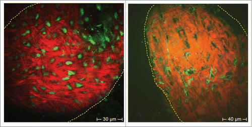 Figure 4. ND-GFP-expressing (left) and label-free HAP stem cells (non-GFP, right) in the dermal papilla. HAP stem cells were imaged with 2-photon induced GFP or by autofluorescence, respectively. Extracellular matrix protein collagen was imaged due to SHG. In the GFP fluorescence image the entire HAP stem cell fluoresced bright green (left panel). In the autofluorescence image (right panel), the cell nucleus appeared dark due to the lack of endogenous fluorophores. Bright autofluorescent structures are in the mitochondria within the cytoplasm, which are rich in intrinsic fluorescent NAD(P)H and flavins. Collagen fibers visualized by SHG are well aligned structures (red [pseudo color coded]).