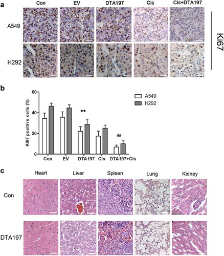 Figure 7. Histopathological analysis of the mice. (a). Representative fields of the immunohistochemical staining of the Ki67 from the A549- or NCL-H292-xenografted tumors. (b). Statistical data of the Ki67-positive cells. The Adsur-DTA197 treatment resulted in a decreased percentage of Ki67-positive cells in comparison with the two control groups (**p < .01). The cisplatin plus Adsur-DTA197 group showed fewer Ki67-positive cells in comparison with the cisplatin group (##p < .01). (c). Representative fields of the sections of the vital organs of the mice. No obvious changes in the sections were found under microscopic examination. Scale bar, 50 µm