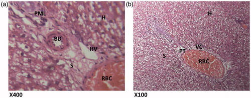 Figure 5. (HAREX 400 mg/kg + paracetamol) Histologic sections through the liver at magnification ×400 (a) and ×100 (b) show reduction in polymorphonuclear aggregation, inflammation, and minimal congestion of the vessels and numerous hepatocytes with good display of portal triad. Conclusion: Slightly affected. PML – polymorphonuclear leucocytes; H – hepatocytes; BD – bile duct; HV – hepatic vein; S – sinusoidal layer; RBC – red blood cell; VC – vascular congestion; PT – portal triad.