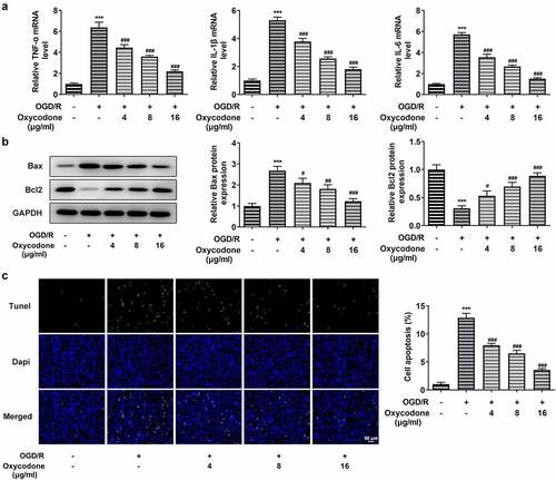 Figure 3. Oxycodone reduced inflammatory cytokine release and apoptosis of OGD/R-induced brain microvascular endothelial cells. (a) The levels of TNF-α, IL-1β and IL-6 were detected using RT-qPCR. (b) The expressions of apoptosis-related proteins were detected using Western blot. (c) The apoptosis was detected using TUNEL. ***P < 0.05 vs. control; #P < 0.05, ##P < 0.01 and ###P < 0.001 vs. OGD/R.