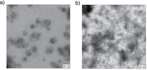 Fig. 1.  Morphology of AB1 tumour exosome (left) in comparison to necrotic AB1 tumour cell lysate (b) visualised by electron microscopy.
