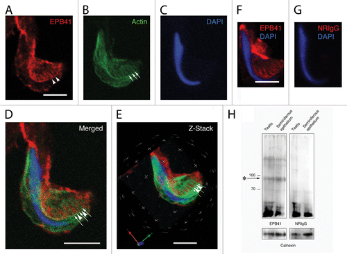 Figure 5. Localization of EPB41 in a Sertoli cell apical process containing a late spermatid when analyzed using confocal microscopy. Shown here are projections of an apical process labeled for EPB41 (A), actin (B), and DNA (C). As with spectrin, EPB41 is present in linear tracts (arrowheads in A) that reflect the positions of actin networks in adjacent tubulobulbar complexes (arrows in B). When the projections of the channels are merged (D) or when the Z-stacks are analyzed in 3D using Velocity software (E), it is evident that the probe for EPB41 is concentrated between adjacent actin networks of tubulobulbar complexes. The staining pattern for EPB41 (F) is absent when normal rabbit IgG is used to replace the primary antibody for EPB41 (G). (H) Western blot of testis and seminiferous epithelium lysates labeled with the EPB41 antibody and with normal rabbit IgG. A prominent band (asterisk) within the molecular weight for EPB41 is present in material labeled with the antibody that is not present in material labeled with normal mouse IgG, as are a couple of weaker bands at a higher molecular weight. Bars = 5.0 μm. To control for protein loading, bots were stripped and re-probed for calnexin.