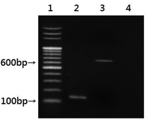 FIG. 1 Identification of E. faecalis and E. faecium in airborne field samples by gel analysis of PCR products. Lane 1: 1 kb DNA ladder; lane 2: E. faecalis; lane 3: E. faecium; lane 4: sterile water.