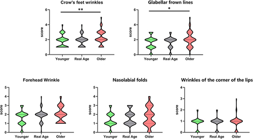 Figure 3 Wrinkle score among three perceived age groups in women aged 31–40.