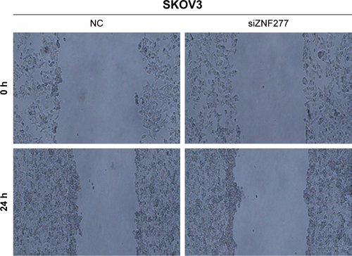 Figure S1 ZNF277 promoted migration in OC cells. Wound healing assay was performed in SKOV3 cells following transfection with NC and siZNF277. Pictures of the wound closure rate are shown.Abbreviations: OC, ovarian cancer; NC, negative control.