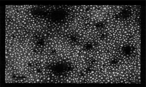 Figure 1. Electron micrograph of PorB proteosomes.Micellar multi-molecular organized clusters of PorB termed “proteosomes”. The scale bar is in the lower left corner and measures 100nm. Each proteosome is approximately 10nm in diameter. This electron micrograph was generated by Dr Lee Wetzler