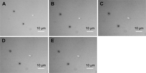 Figure 11 Fluorescence images of Staphylococcus aureus growth in presence of Ag-doped CeONP with MIC50 dose.Notes: Growth with 1.0 mg/mL Ag-doped CeONP, the incubation time increases every 30 minutes (A) 0, (B) 30, (C) 60, (D) 90, and (E) 120 minutes. The ROS fluorescence signifies the intracellular ROS formation.Abbreviations: CeONP, cerium oxide nanoparticles; MIC50, minimal inhibitory concentrations required to inhibit the growth of 50% of bacteria; ROS, reactive oxygen species.