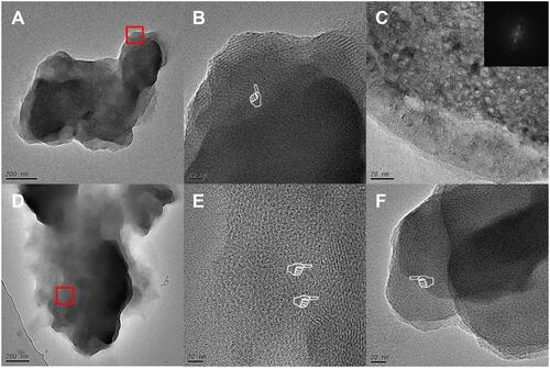 Figure 2 TEM results. (A) TEM image of untreated MDP-Ca salt. (B) Formation of nanolayered structure on untreated MDP-Ca salt, as observed by TEM. (C) TEM image of crystallites within untreated MDP-Ca salt and corresponding diffraction pattern obtained by FFT. (D) TEM image of MDP-Ca salt by attack with acidic solution for 15 min. (E) Discontinuous nanolayered structure of MDP-Ca salt by attack with acidic solution for 15 min. (F) Nanolayered structure of MDP-Ca salt by attack with neutral solution for 15 min.