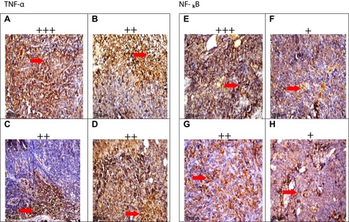 Figure 11 Effect of treatment of TAM, SIM, and their combinations on TNF-α and NF-κB expression in EAC solid tumor. Immunohistochemical staining of TNF-α in EAC solid tumor sections (x40) control (A), TAM (2.5 mg/kg) (B), SIM (2 mg/kg) (C), and combination (D). Immunohistochemical staining of NF-κB in EAC solid tumor sections (x40). Control (E), TAM (2.5 mg/kg) (F), SIM (2 mg/kg) (G), and combination (H).