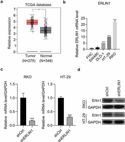Figure 2. Erlin1 was strongly upregulated in CRC tissues.