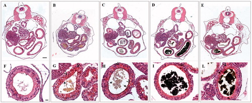 Figure 5. Histological transversal sections of stage 46 X. laevis embryos at level of abdominal region. Low (A–E) and high magnification (F–L) of a control (A and F) and embryos exposed to 25 mg Fe/L of FeSO4 (B and G), FeCl3 (C and H), ZVI NPs (D and I) and Fe3O4 NPs (E and L). In all treated embryos is appreciable the presence of material in the intestinal loops related to iron salts (B, C and G, H) and NPs (D, E and I, L). Damages at brush border (black arrow) and yolk platelets accumulation (arrowhead) in enterocytes are visible. Bars = 100 µm (low magnification) and 20 µm (high magnification).