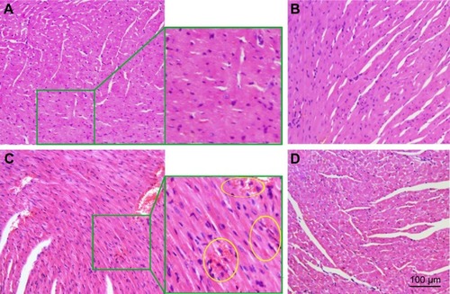 Figure 11 Effect of CMCNa, MSNS, 6MP plus CDDP and MSNS-6MP/CDDP on mouse myocardium histology.