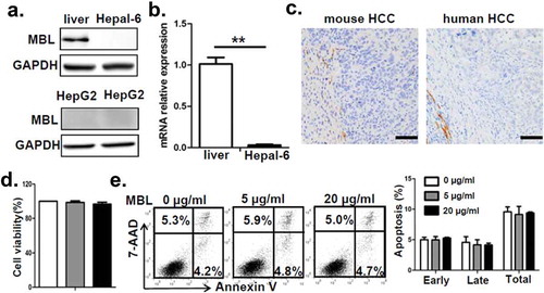 Figure 2. MBL does not directly affect tumor cell biology.(a) MBL expression in mouse liver tissue, Hepal-6 cells and HepG2 cells was detected by immunoblotting analyses. (b) mRNA expression of MBL in Hepal-6 cells was determined by RT-PCR. (c) Representative images of immunohistochemistry staining of MBL in tumor tissues from mice bearing HCC or HCC patients. Scale bars, 50 μm. HepG2 cells were cultured with 0 µg/ml (blank bar), 5 µg/ml (grey bar) and 20µg/ml (black bar) MBL and then the cell proliferation (d) and apoptosis (e) was analyzed by CCK8 assay and flow cytometry, respectively. The percentages represent the frequency of the cells undergoing early apoptosis (Annexin-V+7-AAD−) or late apoptosis (Annexin-V+7-AAD+). Data from at least three independent experiments are presented as mean± SEM.