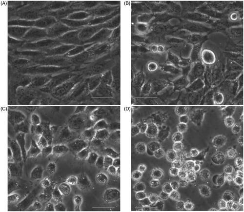Figure 2. Changes of cell morphology after exposure to different concentrations of ZnO nanoparticles for 6 h. (A) Control cells; (B) cells treated with 31.25; (C) 62.5 and (D) 125.0 μmol/l ZnO nanoparticles, respectively. Bar =20 μm.