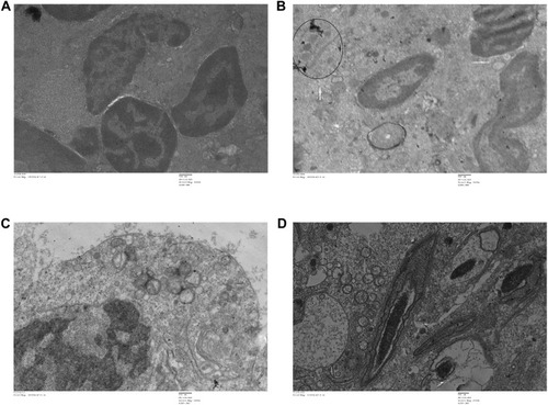 Figure 13 Transmission electron microscopy (TEM) images of different organs (E and F of spleen, and C and D of testis) of Wistar rats treated with IONPs and control. (A) Control and (B) 30 mg/kg-treated group's Spleen ultrastructure shows, vacuolization in cytoplasm (white arrows), nanoparticles (black circles). (C) Control and (D) 30 mg/kg-treated group's ultrastructure of testis-treated group shows degenerated and highly vacuolated cytoplasm (red arrows).