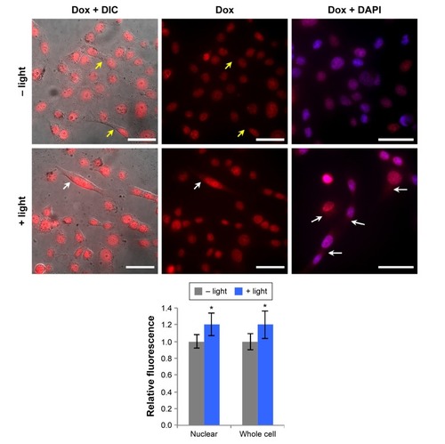 Figure 4 Analysis of dox accumulation and distribution in cells exposed to nanoshells with or without light exposure.Notes: Within the images, red indicates dox and blue indicates nuclei. The first and second columns display the same field-of-view and the third column displays a different field-of-view. Yellow arrows indicate cytoplasmic regions of cells exposed to nanoshells without near-infrared (NIR) light, which display minimal dox fluorescence. White arrows indicate cytoplasmic regions of cells exposed to nanoshells with NIR light, which display amplified dox fluorescence. ImageJ analysis of fluorescence intensity in whole cells or specifically in nuclei is shown in the chart. Asterisks indicate P<0.0001 relative to cells not exposed to NIR light according to Student’s t-test. Scale bars =50 μm.Abbreviations: DIC, differential interference contrast; dox, doxorubicin; DAPI, 4′,6-diamidino-2-phenylindole.